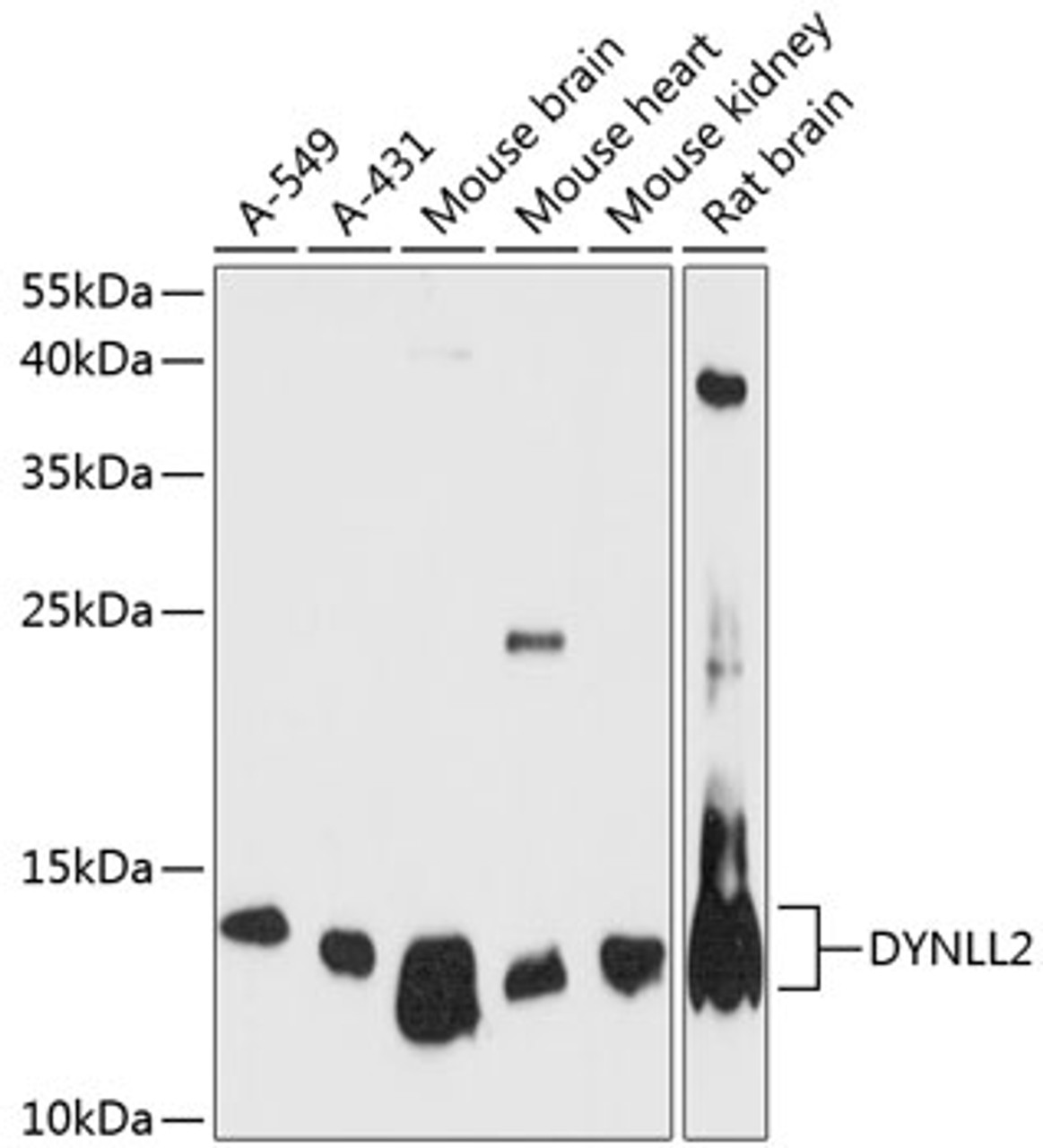 Western blot analysis of extracts of various cell lines, using DYNLL2 antibody (15-250) at 1:3000 dilution.<br/>Secondary antibody: HRP Goat Anti-Rabbit IgG (H+L) at 1:10000 dilution.<br/>Lysates/proteins: 25ug per lane.<br/>Blocking buffer: 3% nonfat dry milk in TBST.<br/>Detection: ECL Enhanced Kit.<br/>Exposure time: 90s.