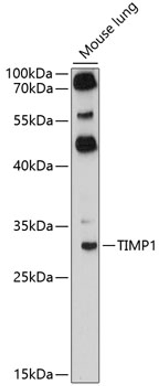 Western blot analysis of extracts of mouse lung, using TIMP1 antibody (15-251) at 1:3000 dilution.<br/>Secondary antibody: HRP Goat Anti-Rabbit IgG (H+L) at 1:10000 dilution.<br/>Lysates/proteins: 25ug per lane.<br/>Blocking buffer: 3% nonfat dry milk in TBST.<br/>Detection: ECL Enhanced Kit.<br/>Exposure time: 90s.