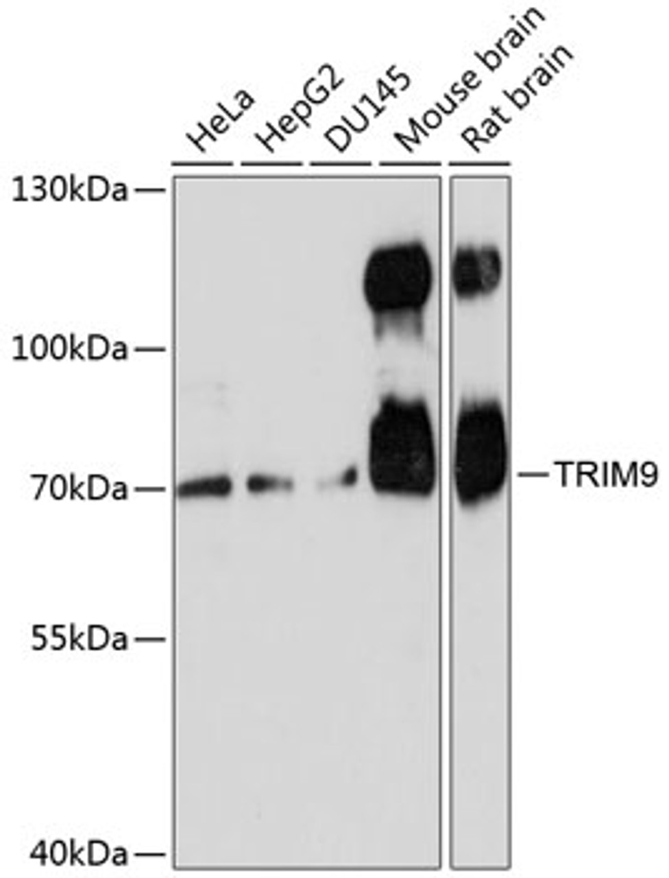 Western blot analysis of extracts of various cell lines, using TRIM9 antibody (15-256) at 1:3000 dilution.<br/>Secondary antibody: HRP Goat Anti-Rabbit IgG (H+L) at 1:10000 dilution.<br/>Lysates/proteins: 25ug per lane.<br/>Blocking buffer: 3% nonfat dry milk in TBST.<br/>Detection: ECL Basic Kit.<br/>Exposure time: 90s.