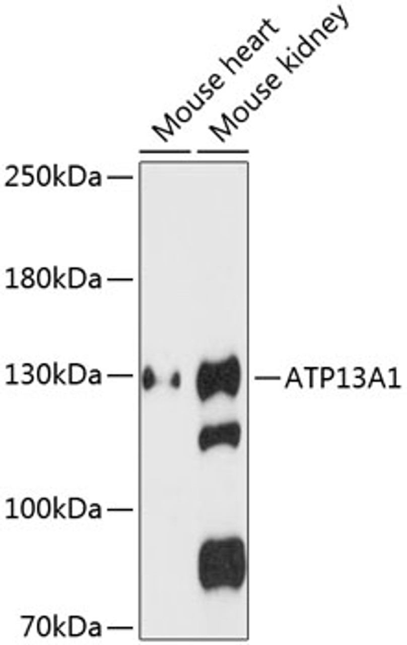 Western blot analysis of extracts of various cell lines, using ATP13A1 antibody (15-257) at 1:3000 dilution.<br/>Secondary antibody: HRP Goat Anti-Rabbit IgG (H+L) at 1:10000 dilution.<br/>Lysates/proteins: 25ug per lane.<br/>Blocking buffer: 3% nonfat dry milk in TBST.<br/>Detection: ECL Enhanced Kit.<br/>Exposure time: 90s.