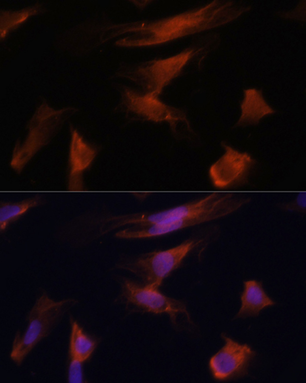 Immunofluorescence analysis of U2OS cells using ADA antibody (15-263) at dilution of 1:100. Blue: DAPI for nuclear staining.