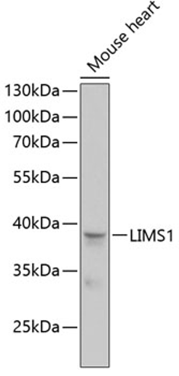 Western blot analysis of extracts of mouse heart, using LIMS1 antibody (15-265) at 1:1000 dilution.<br/>Secondary antibody: HRP Goat Anti-Rabbit IgG (H+L) at 1:10000 dilution.<br/>Lysates/proteins: 25ug per lane.<br/>Blocking buffer: 3% nonfat dry milk in TBST.<br/>Detection: ECL Enhanced Kit.<br/>Exposure time: 90s.