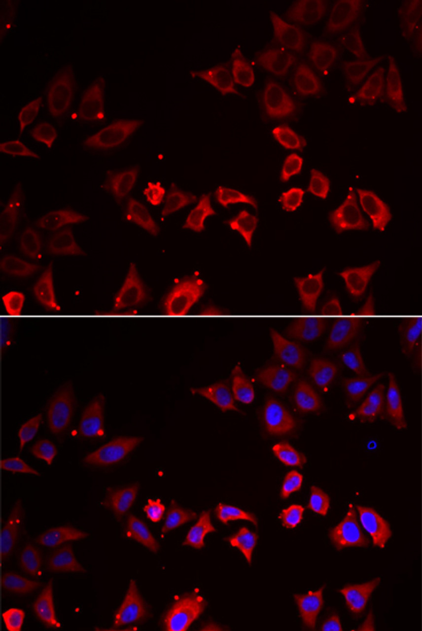 Immunofluorescence analysis of A549 cells using LIMS1 antibody (15-265) . Blue: DAPI for nuclear staining.