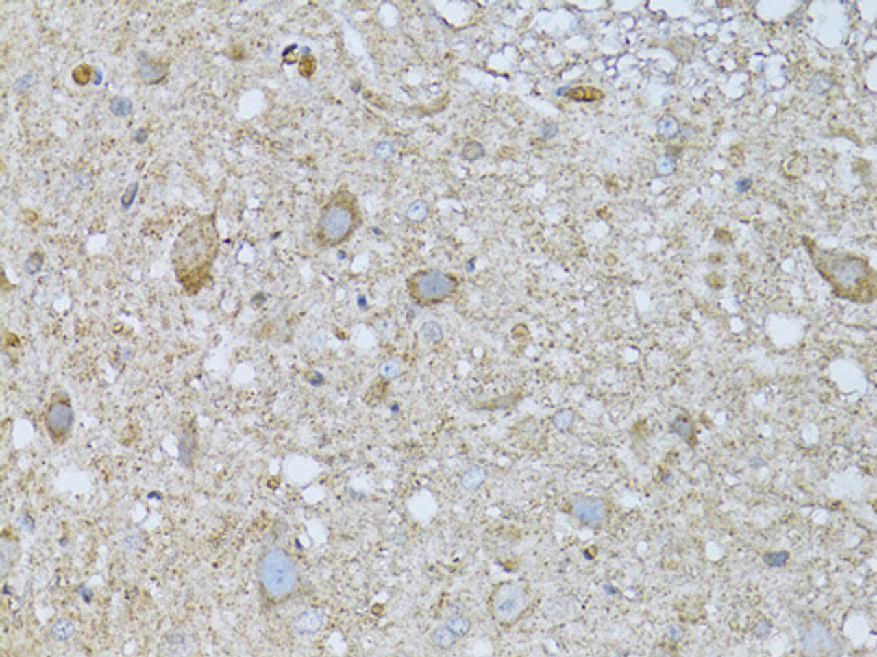 Immunohistochemistry of paraffin-embedded rat spinal cord using PHLDA2 antibody (15-268) at dilution of 1:100 (40x lens) .