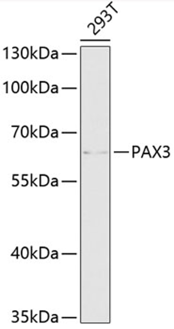 Western blot analysis of extracts of 293T cells, using PAX3 antibody (15-273) at 1:1000 dilution.<br/>Secondary antibody: HRP Goat Anti-Rabbit IgG (H+L) at 1:10000 dilution.<br/>Lysates/proteins: 25ug per lane.<br/>Blocking buffer: 3% nonfat dry milk in TBST.<br/>Detection: ECL Basic Kit.<br/>Exposure time: 30s.