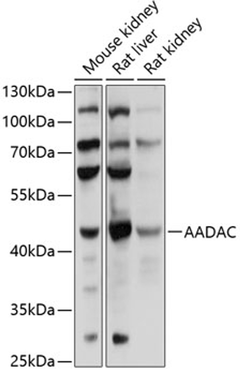 Western blot analysis of extracts of various cell lines, using AADAC antibody (15-276) at 1:1000 dilution.<br/>Secondary antibody: HRP Goat Anti-Rabbit IgG (H+L) at 1:10000 dilution.<br/>Lysates/proteins: 25ug per lane.<br/>Blocking buffer: 3% nonfat dry milk in TBST.<br/>Detection: ECL Basic Kit.<br/>Exposure time: 20s.
