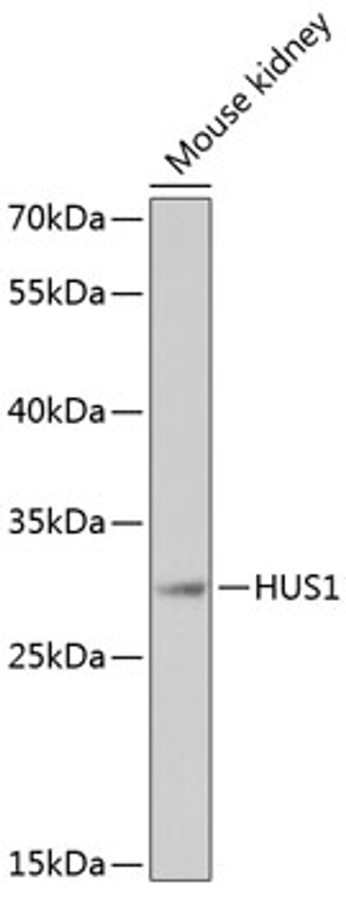 Western blot analysis of extracts of mouse kidney, using HUS1 antibody (15-278) at 1:1000 dilution.<br/>Secondary antibody: HRP Goat Anti-Rabbit IgG (H+L) at 1:10000 dilution.<br/>Lysates/proteins: 25ug per lane.<br/>Blocking buffer: 3% nonfat dry milk in TBST.<br/>Detection: ECL Basic Kit.<br/>Exposure time: 180s.