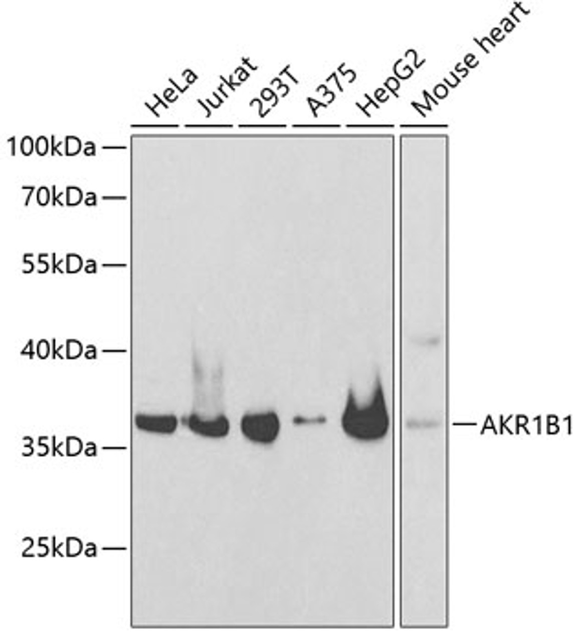 Western blot analysis of extracts of various cell lines, using AKR1B1 antibody (15-283) at 1:1000 dilution.<br/>Secondary antibody: HRP Goat Anti-Rabbit IgG (H+L) at 1:10000 dilution.<br/>Lysates/proteins: 25ug per lane.<br/>Blocking buffer: 3% nonfat dry milk in TBST.