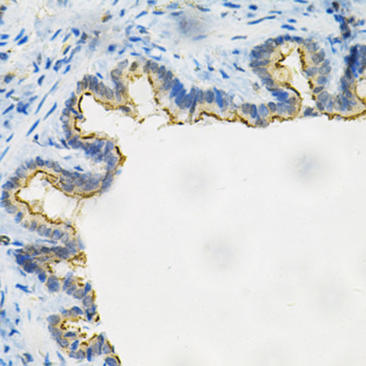 Immunohistochemistry of paraffin-embedded rat lung using AKR1B1 Antibody (15-283) at dilution of 1:100 (40x lens) .