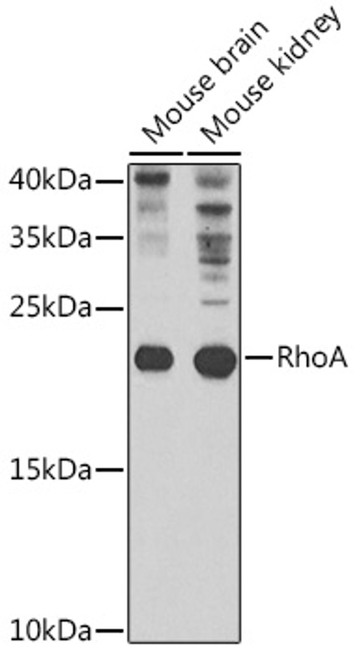 Immunohistochemistry of paraffin-embedded rat brain using RhoA Antibody (15-286) at dilution of 1:100 (40x lens) .