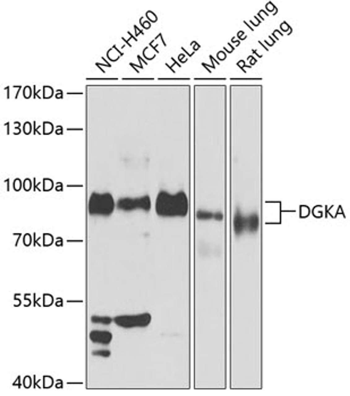 Western blot analysis of extracts of various cell lines, using DGKA antibody (15-299) at 1:1000 dilution.<br/>Secondary antibody: HRP Goat Anti-Rabbit IgG (H+L) at 1:10000 dilution.<br/>Lysates/proteins: 25ug per lane.<br/>Blocking buffer: 3% nonfat dry milk in TBST.<br/>Detection: ECL Enhanced Kit.<br/>Exposure time: 30s.