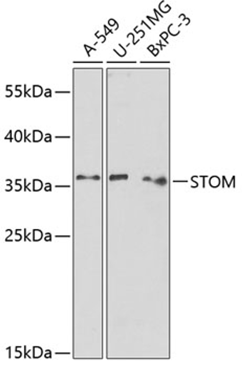 Western blot analysis of extracts of various cell lines, using STOM antibody (15-302) at 1:1000 dilution.<br/>Secondary antibody: HRP Goat Anti-Rabbit IgG (H+L) at 1:10000 dilution.<br/>Lysates/proteins: 25ug per lane.<br/>Blocking buffer: 3% nonfat dry milk in TBST.<br/>Detection: ECL Basic Kit.<br/>Exposure time: 90s.