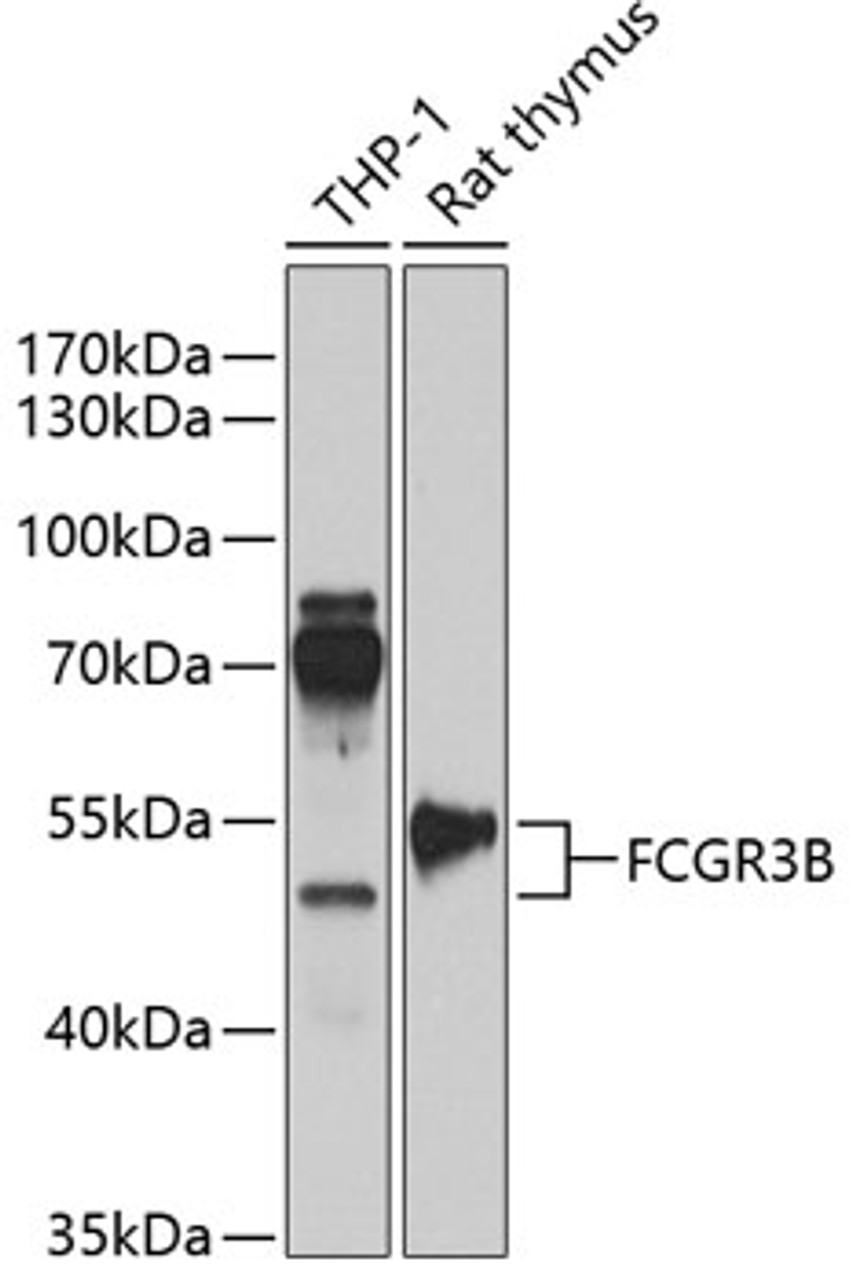 Western blot analysis of extracts of various cell lines, using FCGR3B antibody (15-304) at 1:1000 dilution.<br/>Secondary antibody: HRP Goat Anti-Rabbit IgG (H+L) at 1:10000 dilution.<br/>Lysates/proteins: 25ug per lane.<br/>Blocking buffer: 3% nonfat dry milk in TBST.<br/>Detection: ECL Enhanced Kit.<br/>Exposure time: 60s.