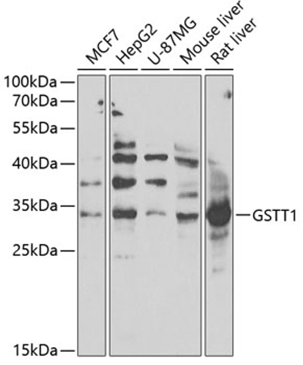 Western blot analysis of extracts of various cell lines, using GSTT1 antibody (15-311) at 1:1000 dilution.<br/>Secondary antibody: HRP Goat Anti-Rabbit IgG (H+L) at 1:10000 dilution.<br/>Lysates/proteins: 25ug per lane.<br/>Blocking buffer: 3% nonfat dry milk in TBST.<br/>Detection: ECL Basic Kit.<br/>Exposure time: 90s.