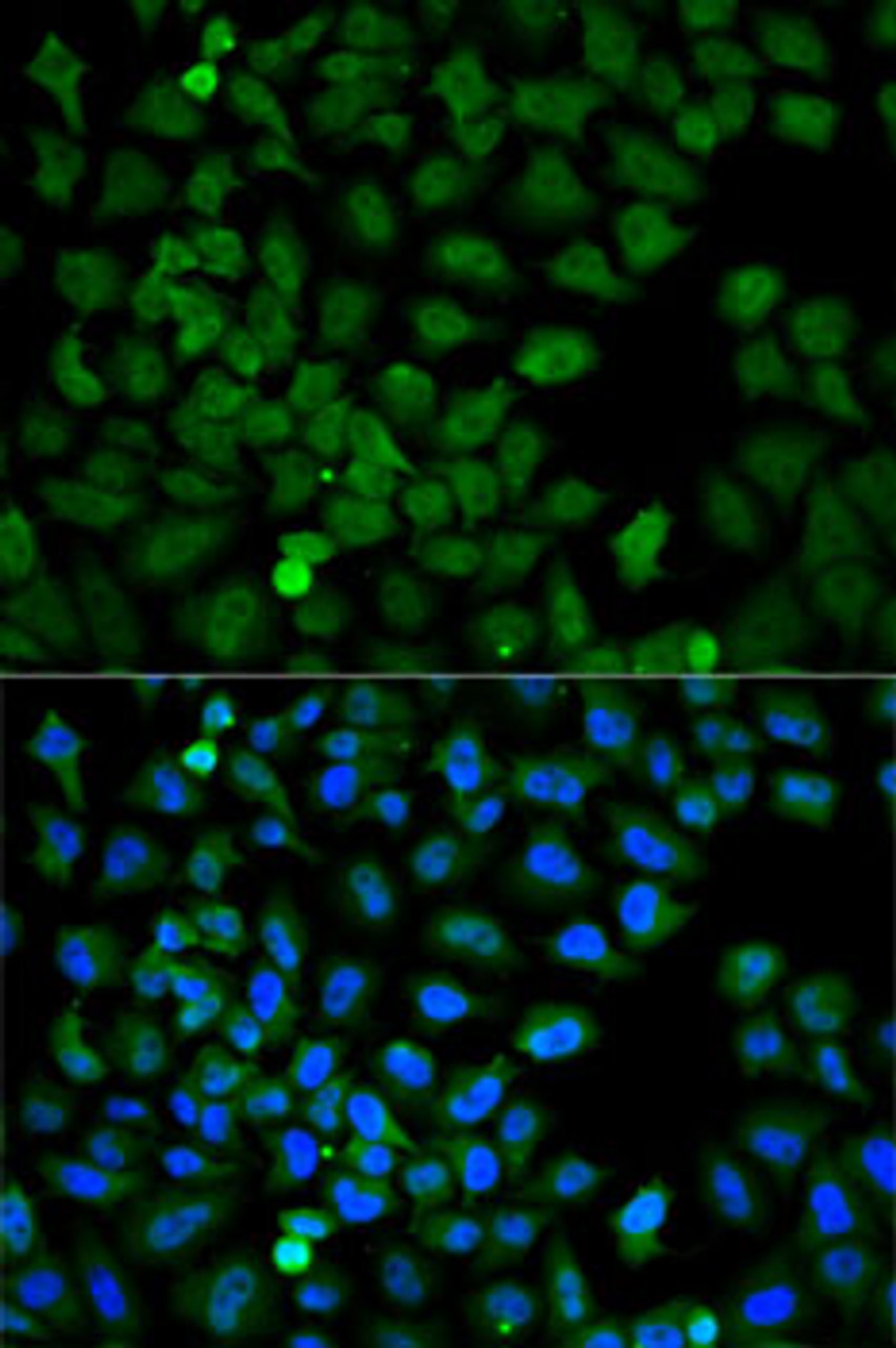 Immunofluorescence analysis of HeLa cells using HSPA8 antibody (15-314) . Blue: DAPI for nuclear staining.