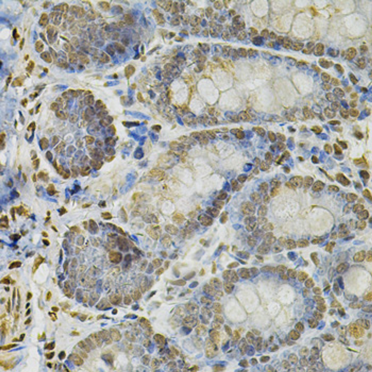 Immunohistochemistry of paraffin-embedded rat intestine using IFI16 Antibody (15-315) at dilution of 1:100 (40x lens) .