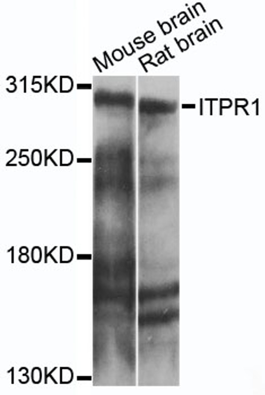 Western blot analysis of extracts of various cell lines, using ITPR1 antibody (15-320) at 1:1000 dilution.<br/>Secondary antibody: HRP Goat Anti-Rabbit IgG (H+L) at 1:10000 dilution.<br/>Lysates/proteins: 25ug per lane.<br/>Blocking buffer: 3% nonfat dry milk in TBST.<br/>Detection: ECL Enhanced Kit.<br/>Exposure time: 10s.