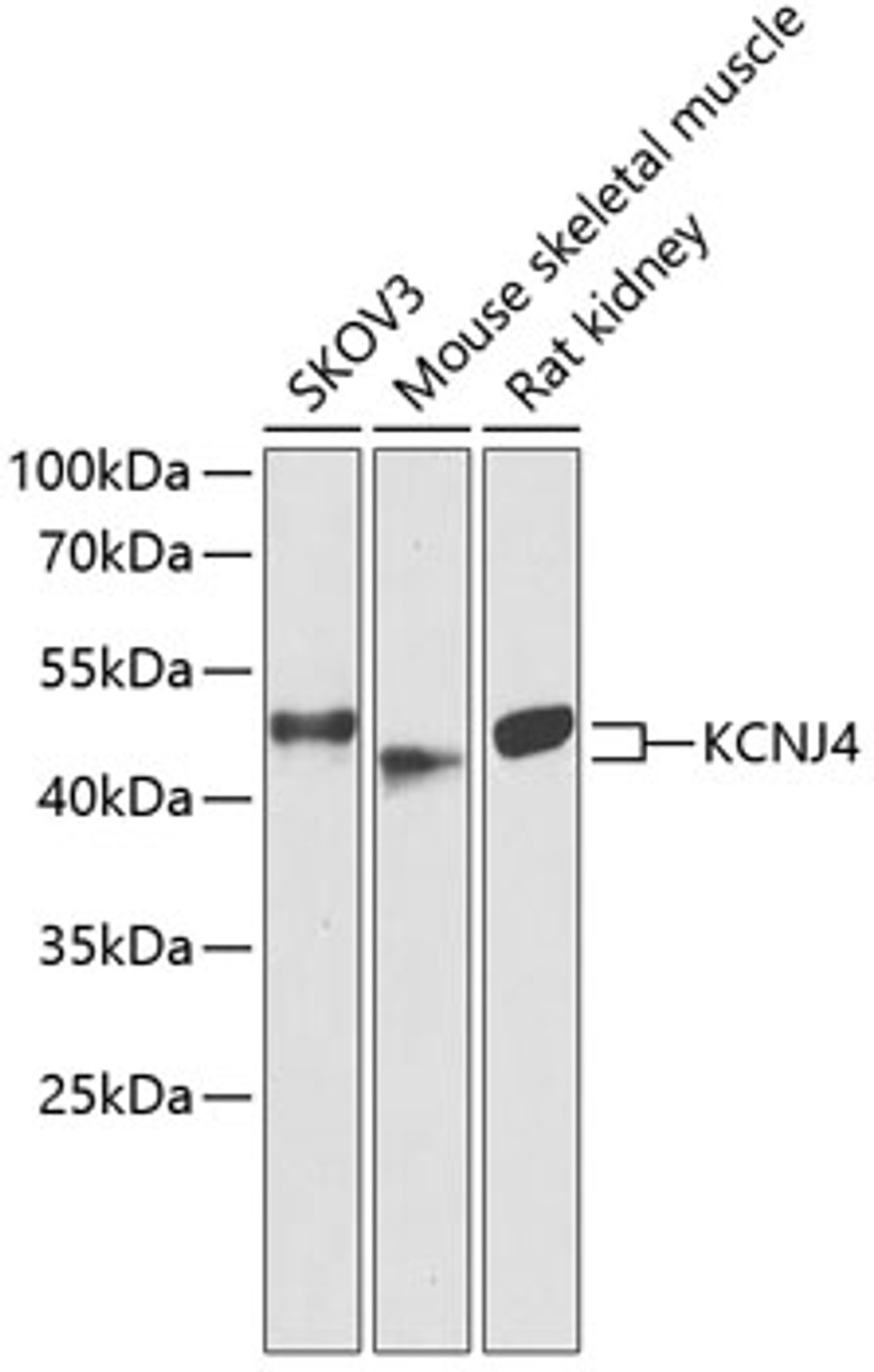 Western blot analysis of extracts of various cell lines, using KCNJ4 antibody (15-322) at 1:1000 dilution.<br/>Secondary antibody: HRP Goat Anti-Rabbit IgG (H+L) at 1:10000 dilution.<br/>Lysates/proteins: 25ug per lane.<br/>Blocking buffer: 3% nonfat dry milk in TBST.<br/>Detection: ECL Enhanced Kit.<br/>Exposure time: 30s.