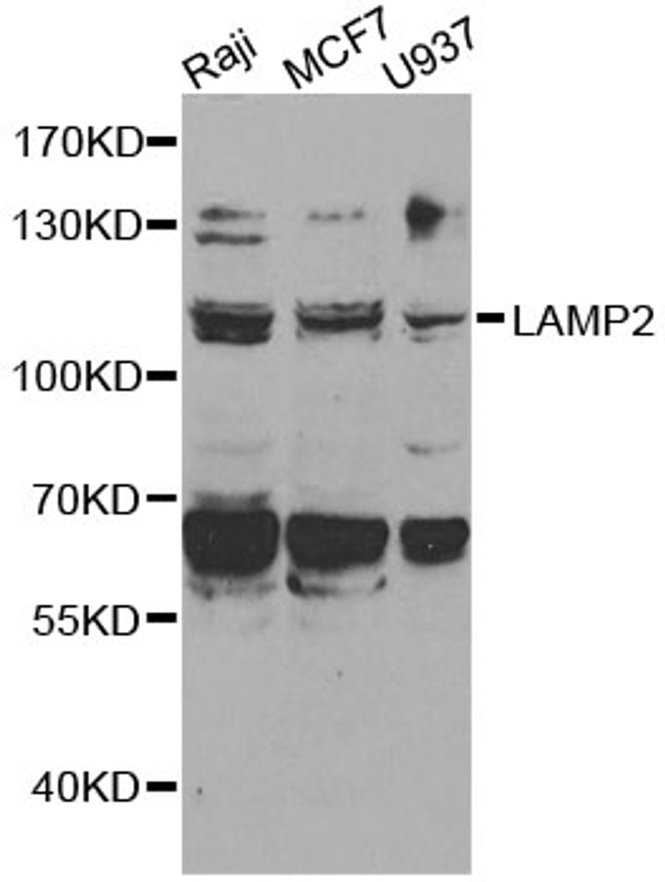 Western blot analysis of extracts of various cell lines, using LAMP2 antibody (15-324) at 1:1000 dilution.<br/>Secondary antibody: HRP Goat Anti-Rabbit IgG (H+L) at 1:10000 dilution.<br/>Lysates/proteins: 25ug per lane.<br/>Blocking buffer: 3% nonfat dry milk in TBST.<br/>Detection: ECL Enhanced Kit.