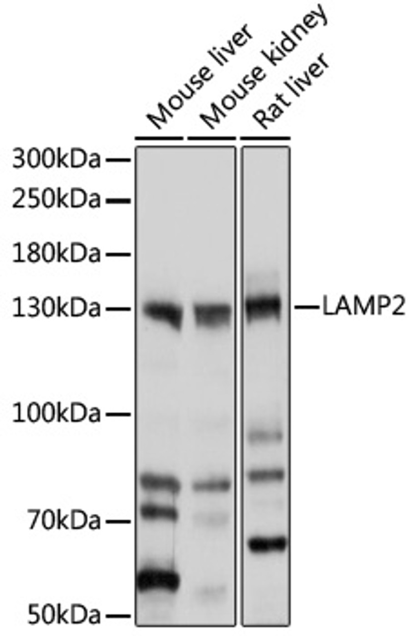 Western blot analysis of extracts of various cell lines, using LAMP2 antibody (15-324) at 1:1000 dilution.<br/>Secondary antibody: HRP Goat Anti-Rabbit IgG (H+L) at 1:10000 dilution.<br/>Lysates/proteins: 25ug per lane.<br/>Blocking buffer: 3% nonfat dry milk in TBST.<br/>Detection: ECL Basic Kit.<br/>Exposure time: 10s.