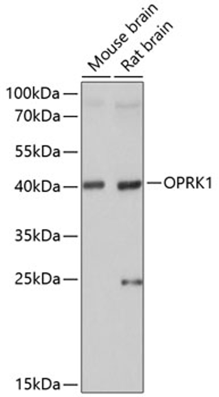 Western blot analysis of extracts of various cell lines, using OPRK1 antibody (15-333) at 1:1000 dilution.<br/>Secondary antibody: HRP Goat Anti-Rabbit IgG (H+L) at 1:10000 dilution.<br/>Lysates/proteins: 25ug per lane.<br/>Blocking buffer: 3% nonfat dry milk in TBST.<br/>Detection: ECL Basic Kit.<br/>Exposure time: 5s.