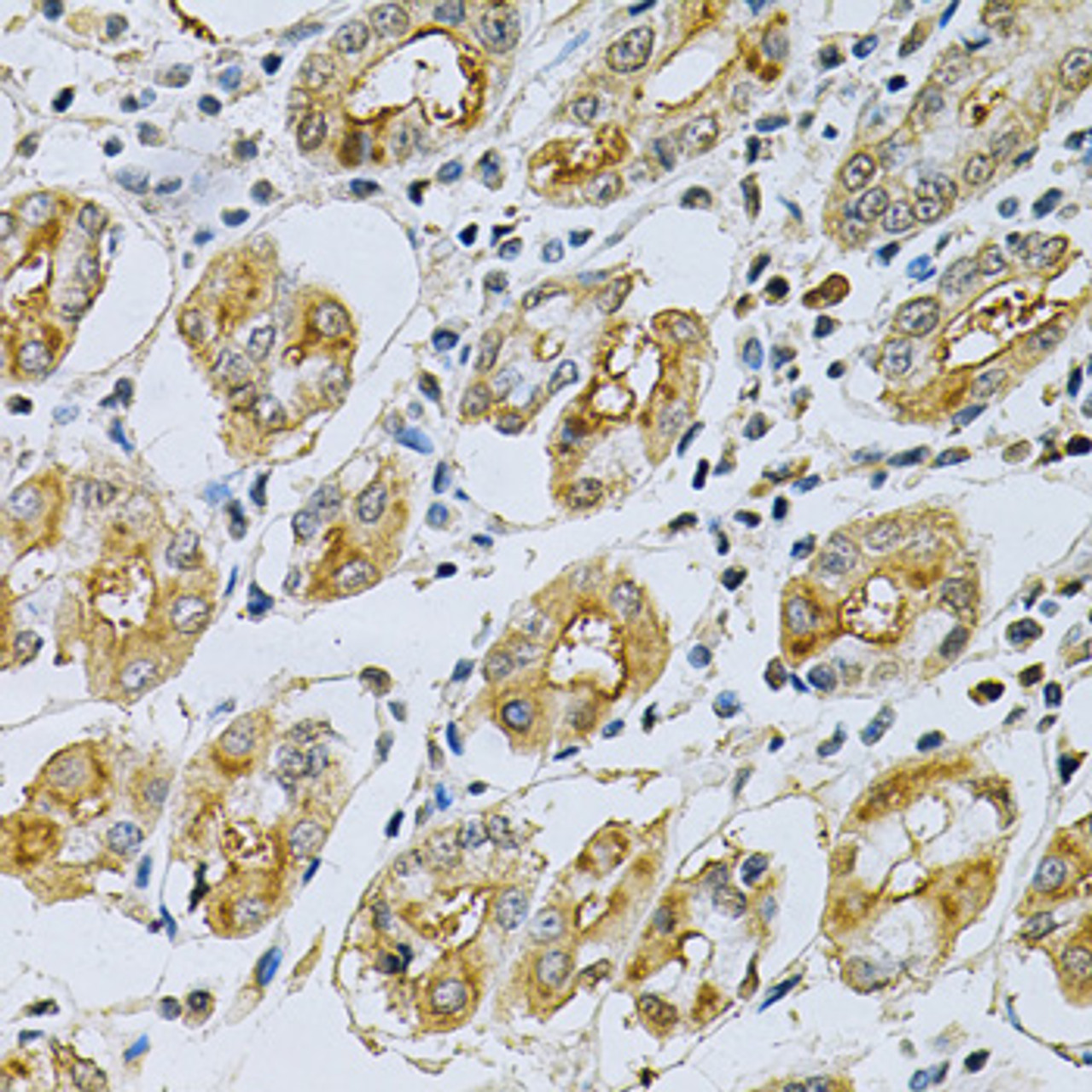 Immunohistochemistry of paraffin-embedded human stomach using SERPINB5 Antibody (15-339) at dilution of 1:200 (40x lens) .