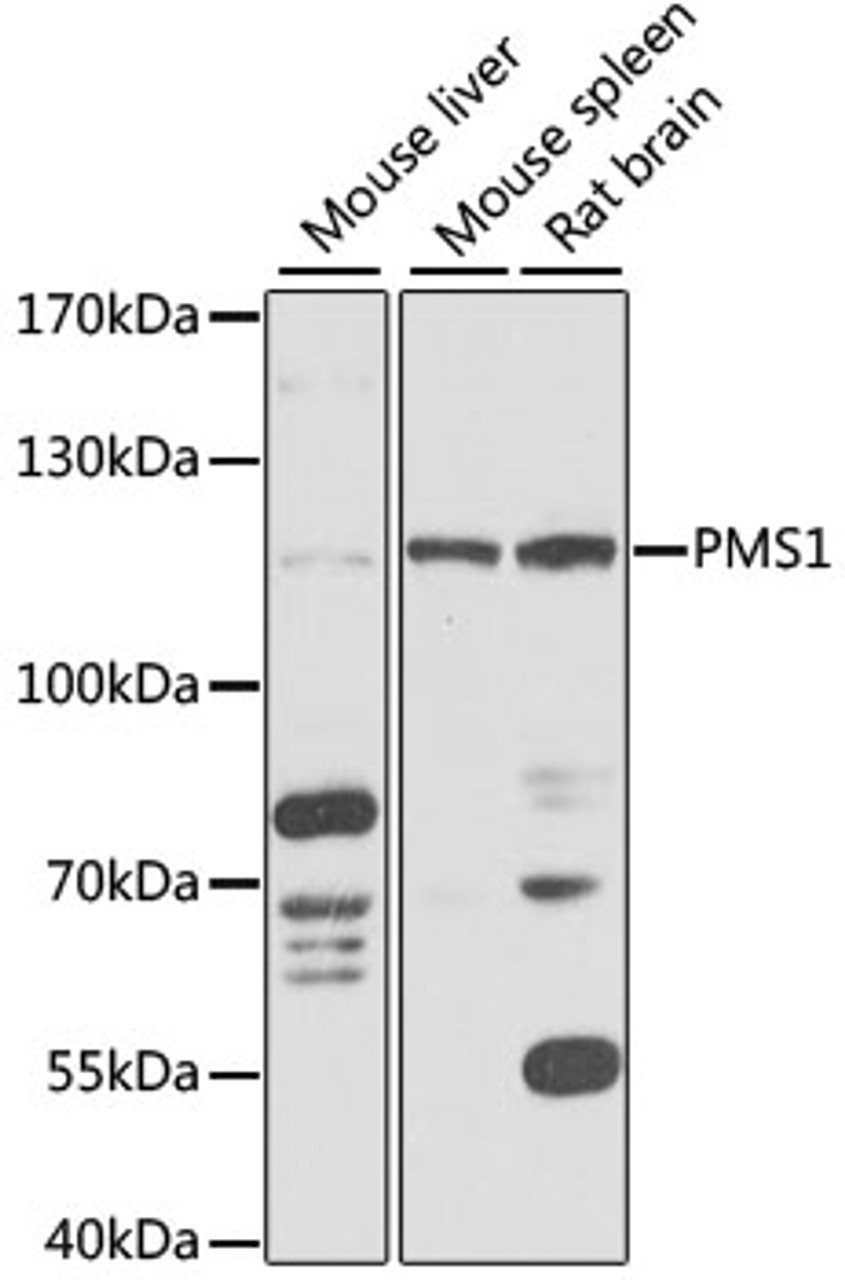 Western blot analysis of extracts of various cell lines, using PMS1 antibody (15-342) at 1:1000 dilution.<br/>Secondary antibody: HRP Goat Anti-Rabbit IgG (H+L) at 1:10000 dilution.<br/>Lysates/proteins: 25ug per lane.<br/>Blocking buffer: 3% nonfat dry milk in TBST.<br/>Detection: ECL Basic Kit.<br/>Exposure time: 5s.