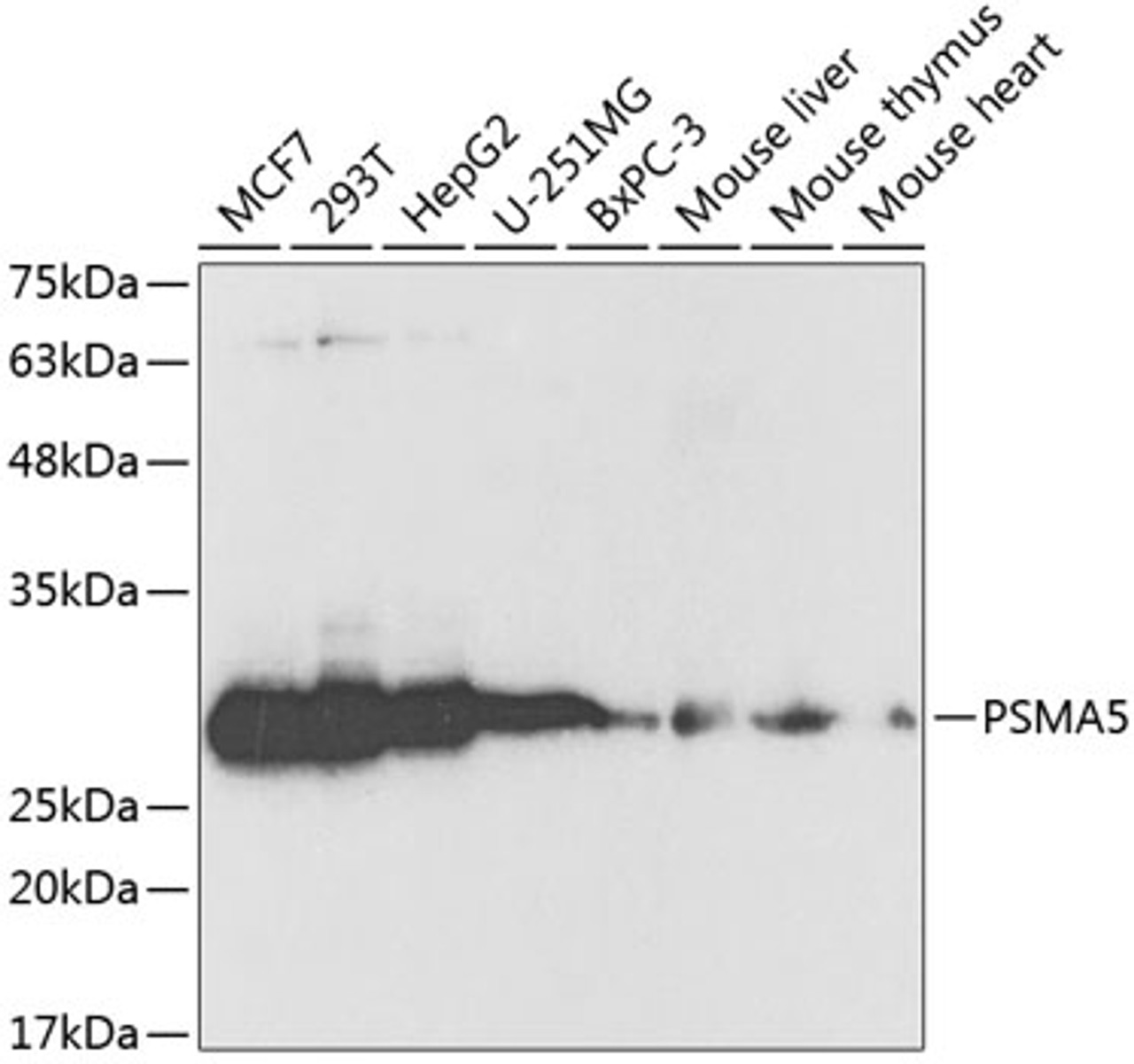 Western blot analysis of extracts of various cell lines, using PSMA5 antibody (15-346) at 1:1000 dilution.<br/>Secondary antibody: HRP Goat Anti-Rabbit IgG (H+L) at 1:10000 dilution.<br/>Lysates/proteins: 25ug per lane.<br/>Blocking buffer: 3% nonfat dry milk in TBST.