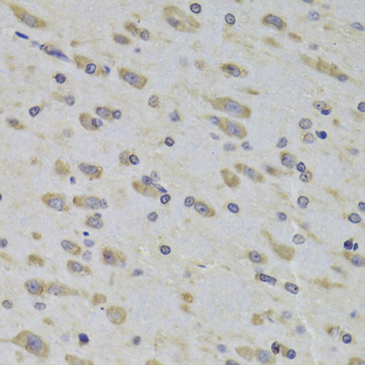 Immunohistochemistry of paraffin-embedded rat brain using RPL3 Antibody (15-349) at dilution of 1:100 (40x lens) .