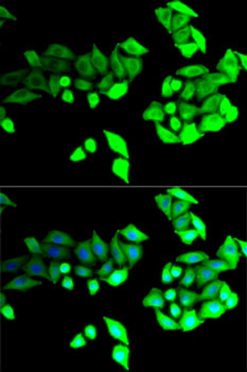 Immunofluorescence analysis of U2OS cells using BEST1 antibody (15-355) . Blue: DAPI for nuclear staining.