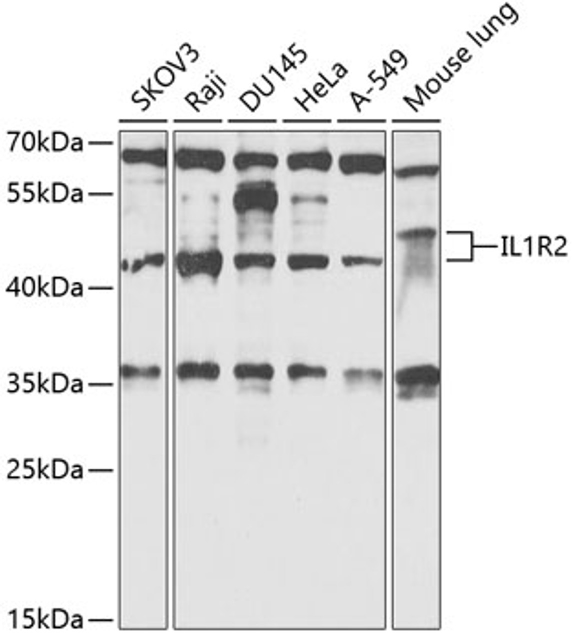 Western blot analysis of extracts of various cell lines, using IL1R2 antibody (15-356) at 1:1000 dilution.<br/>Secondary antibody: HRP Goat Anti-Rabbit IgG (H+L) at 1:10000 dilution.<br/>Lysates/proteins: 25ug per lane.<br/>Blocking buffer: 3% nonfat dry milk in TBST.<br/>Detection: ECL Basic Kit.<br/>Exposure time: 60s.