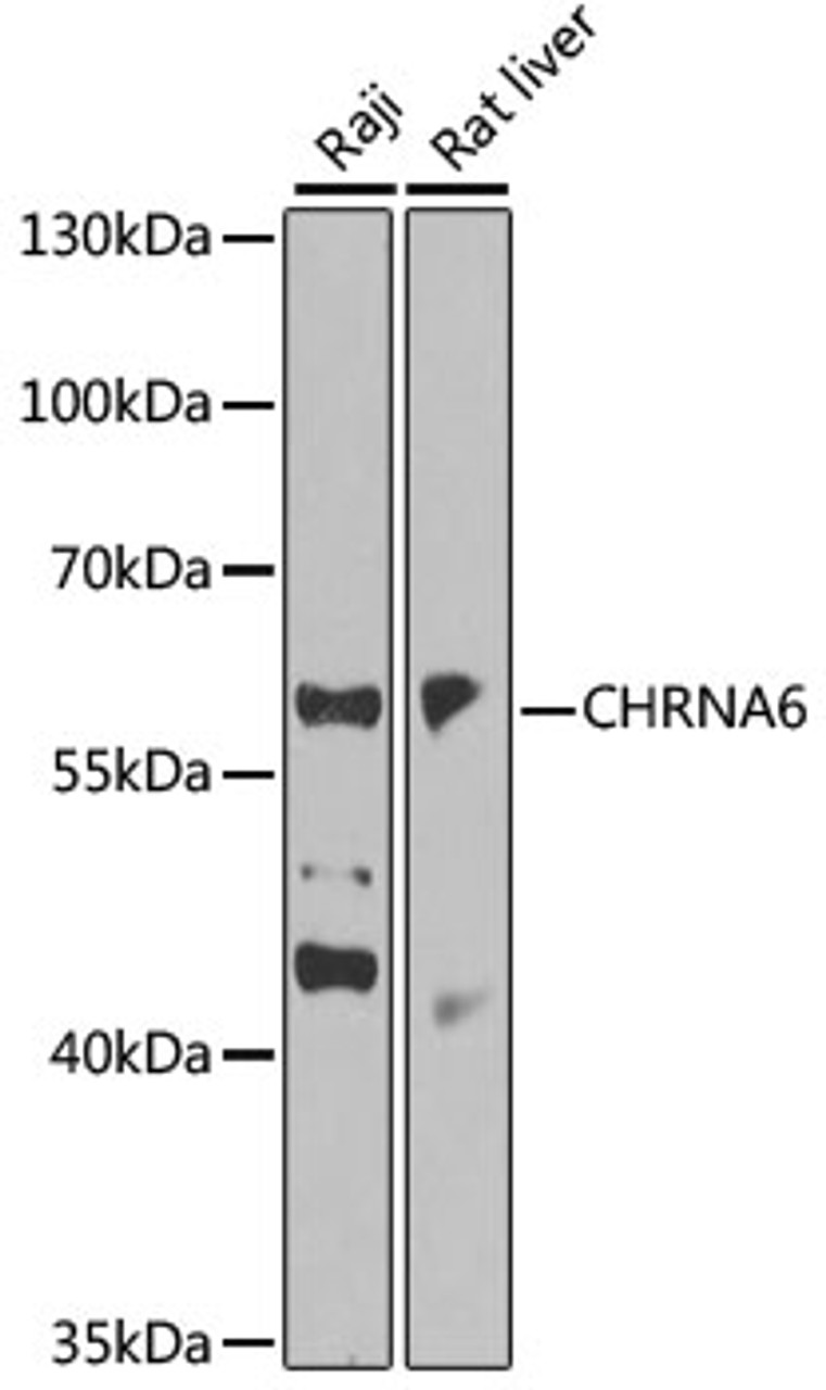 Western blot analysis of extracts of various cell lines, using CHRNA6 antibody (15-362) at 1:1000 dilution.<br/>Secondary antibody: HRP Goat Anti-Rabbit IgG (H+L) at 1:10000 dilution.<br/>Lysates/proteins: 25ug per lane.<br/>Blocking buffer: 3% nonfat dry milk in TBST.<br/>Detection: ECL Basic Kit.<br/>Exposure time: 30s.