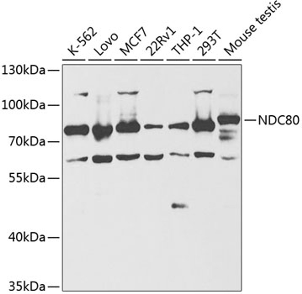 Western blot analysis of extracts of various cell lines, using NDC80 antibody (15-371) at 1:1000 dilution.<br/>Secondary antibody: HRP Goat Anti-Rabbit IgG (H+L) at 1:10000 dilution.<br/>Lysates/proteins: 25ug per lane.<br/>Blocking buffer: 3% nonfat dry milk in TBST.<br/>Detection: ECL Basic Kit.<br/>Exposure time: 60s.