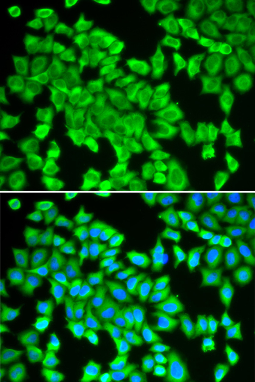 Immunofluorescence analysis of HeLa cells using STIP1 antibody (15-375) . Blue: DAPI for nuclear staining.