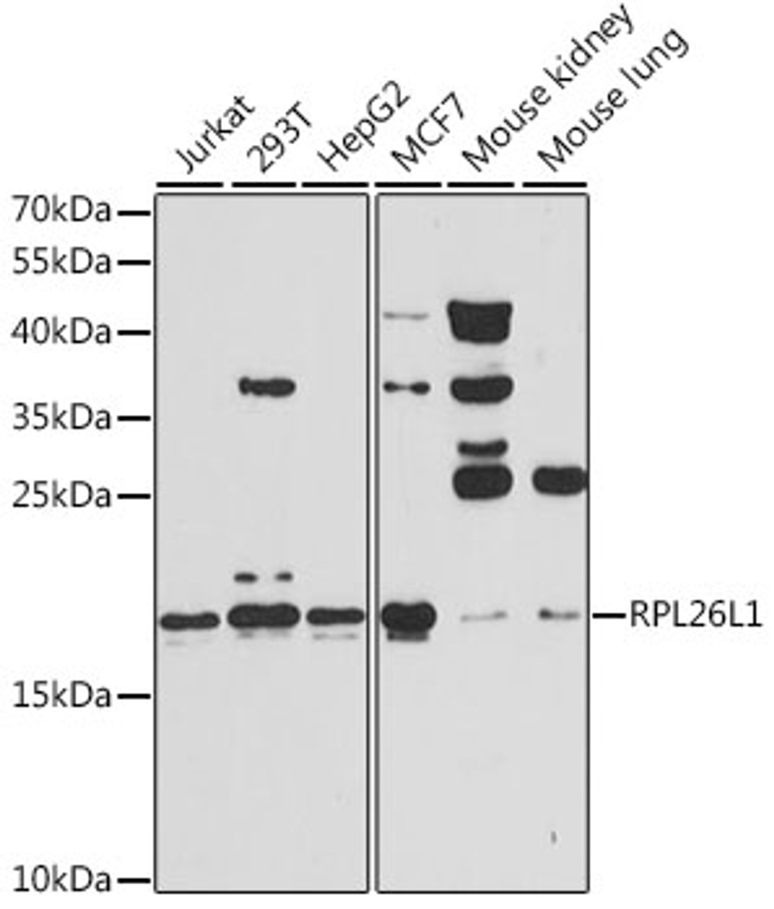 Western blot analysis of extracts of various cell lines, using RPL26L1 antibody (15-385) at 1:3000 dilution.<br/>Secondary antibody: HRP Goat Anti-Rabbit IgG (H+L) at 1:10000 dilution.<br/>Lysates/proteins: 25ug per lane.<br/>Blocking buffer: 3% nonfat dry milk in TBST.<br/>Detection: ECL Basic Kit.<br/>Exposure time: 60s.