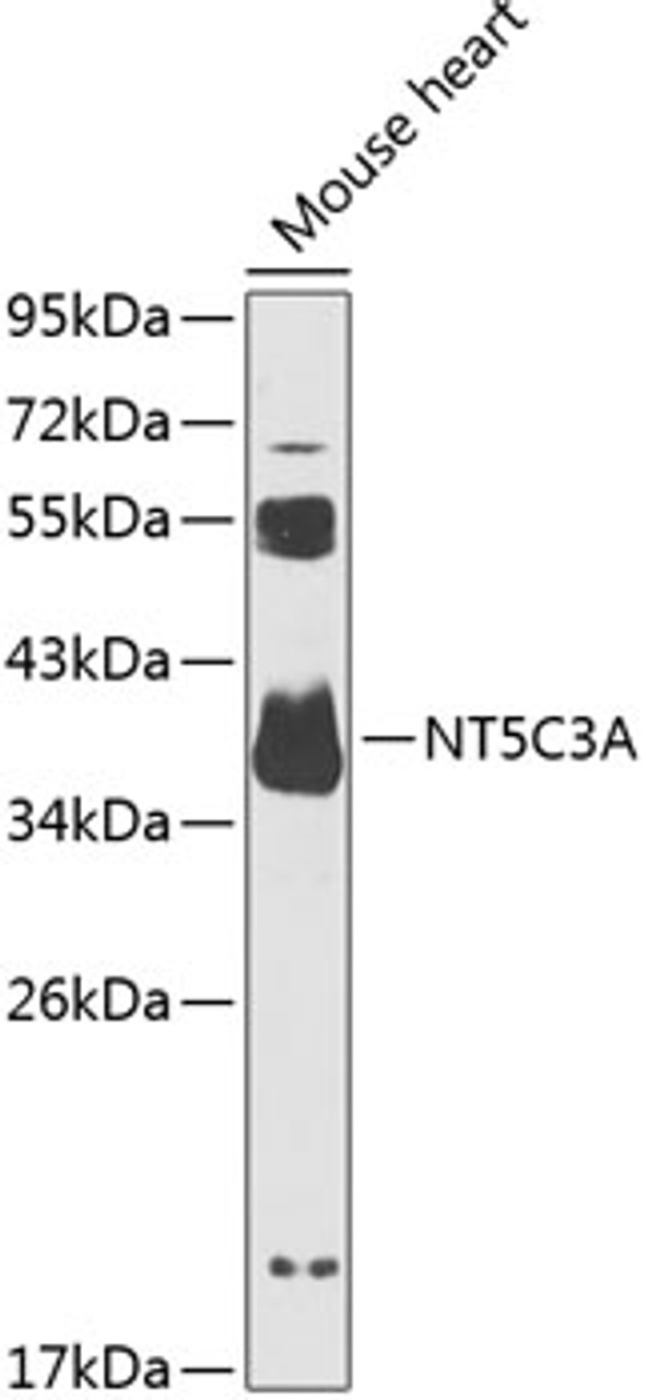Western blot analysis of extracts of mouse brain, using NT5C3A antibody (15-386) at 1:1000 dilution.<br/>Secondary antibody: HRP Goat Anti-Rabbit IgG (H+L) at 1:10000 dilution.<br/>Lysates/proteins: 25ug per lane.<br/>Blocking buffer: 3% nonfat dry milk in TBST.<br/>Detection: ECL Basic Kit.<br/>Exposure time: 90s.