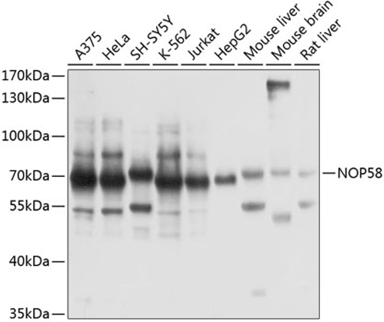 Western blot analysis of extracts of various cell lines, using NOP58 antibody (15-388) at 1:1000 dilution.<br/>Secondary antibody: HRP Goat Anti-Rabbit IgG (H+L) at 1:10000 dilution.<br/>Lysates/proteins: 25ug per lane.<br/>Blocking buffer: 3% nonfat dry milk in TBST.<br/>Detection: ECL Basic Kit.<br/>Exposure time: 5s.