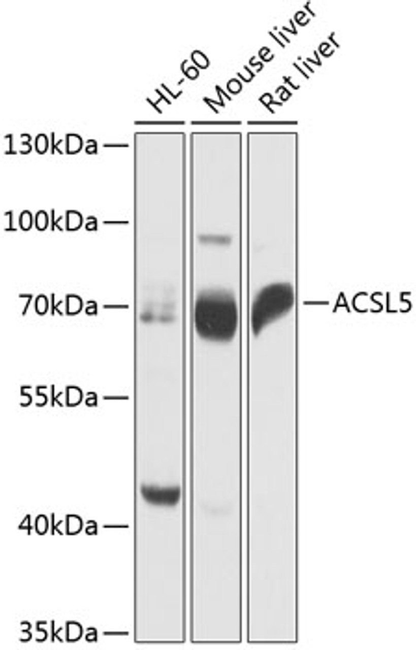 Western blot analysis of extracts of various cell lines, using ACSL5 antibody (15-389) at 1:1000 dilution.<br/>Secondary antibody: HRP Goat Anti-Rabbit IgG (H+L) at 1:10000 dilution.<br/>Lysates/proteins: 25ug per lane.<br/>Blocking buffer: 3% nonfat dry milk in TBST.<br/>Detection: ECL Basic Kit.<br/>Exposure time: 1s.