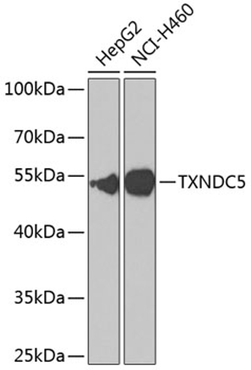 Western blot analysis of extracts of various cell lines, using TXNDC5 antibody (15-399) at 1:1000 dilution.<br/>Secondary antibody: HRP Goat Anti-Rabbit IgG (H+L) at 1:10000 dilution.<br/>Lysates/proteins: 25ug per lane.<br/>Blocking buffer: 3% nonfat dry milk in TBST.<br/>Detection: ECL Basic Kit.<br/>Exposure time: 90s.