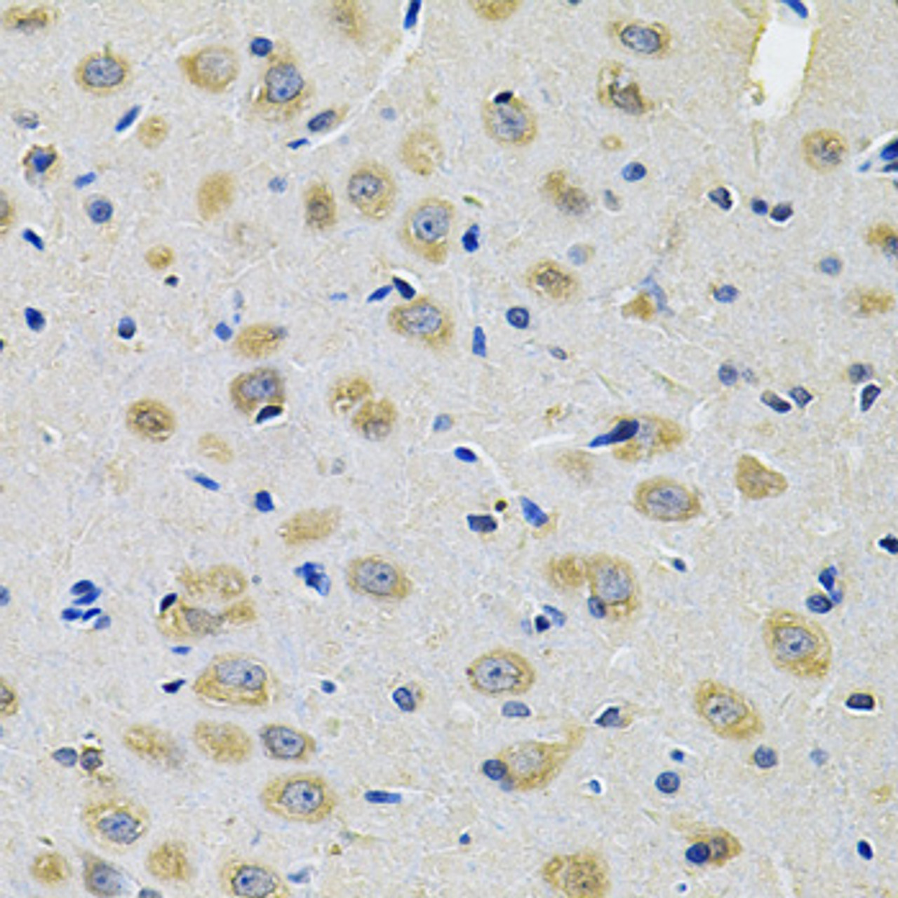 Immunohistochemistry of paraffin-embedded rat brain using TXNDC5 Antibody (15-399) at dilution of 1:100 (40x lens) .
