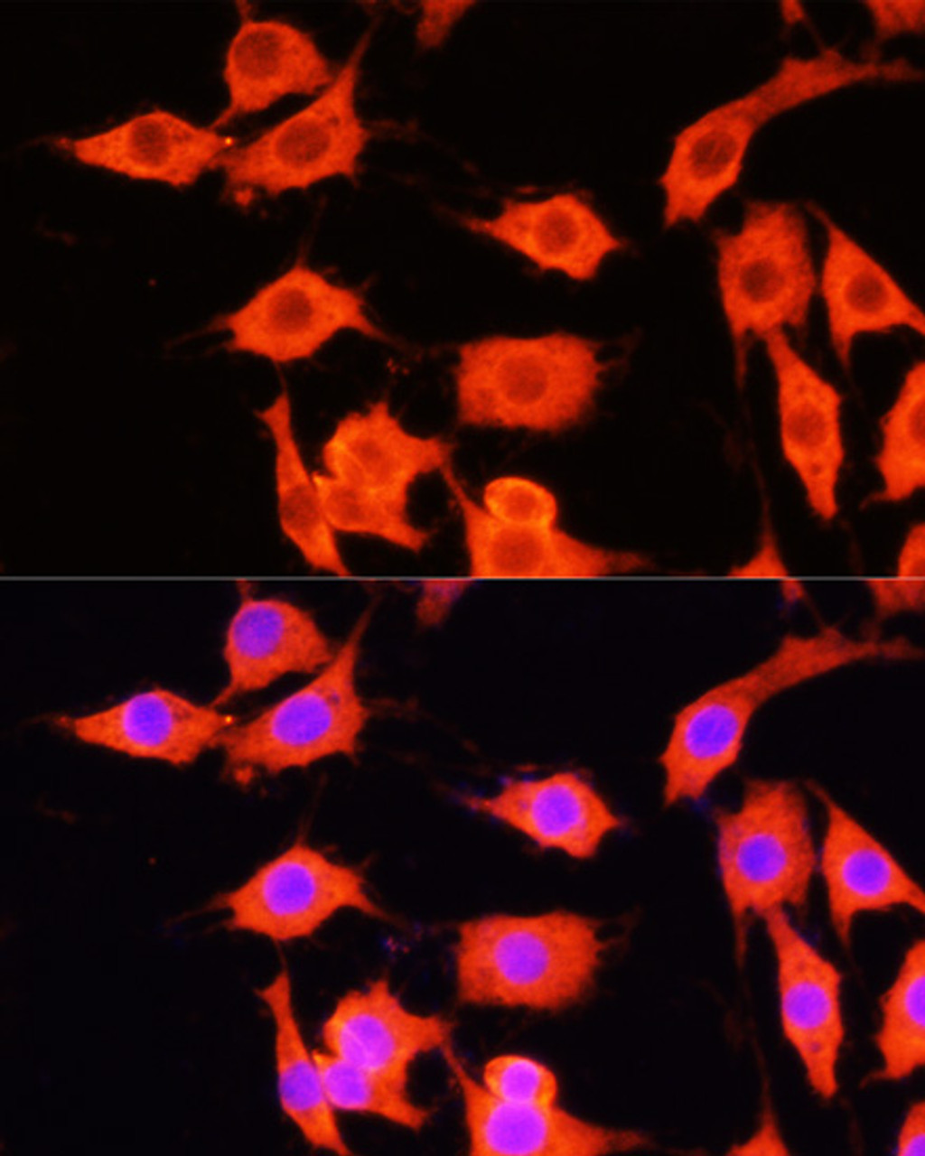 Immunofluorescence analysis of PC-12 cells using SERPINA12 antibody (15-403) at dilution of 1:100 (40x lens) . Blue: DAPI for nuclear staining.