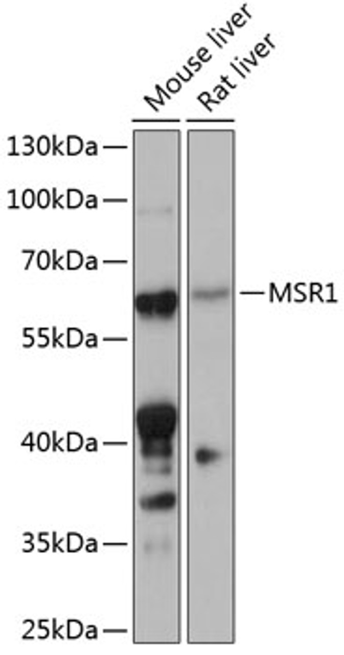 Western blot analysis of extracts of various cell lines, using MSR1 antibody (15-416) at 1:1000 dilution.<br/>Secondary antibody: HRP Goat Anti-Rabbit IgG (H+L) at 1:10000 dilution.<br/>Lysates/proteins: 25ug per lane.<br/>Blocking buffer: 3% nonfat dry milk in TBST.<br/>Detection: ECL Basic Kit.<br/>Exposure time: 90s.