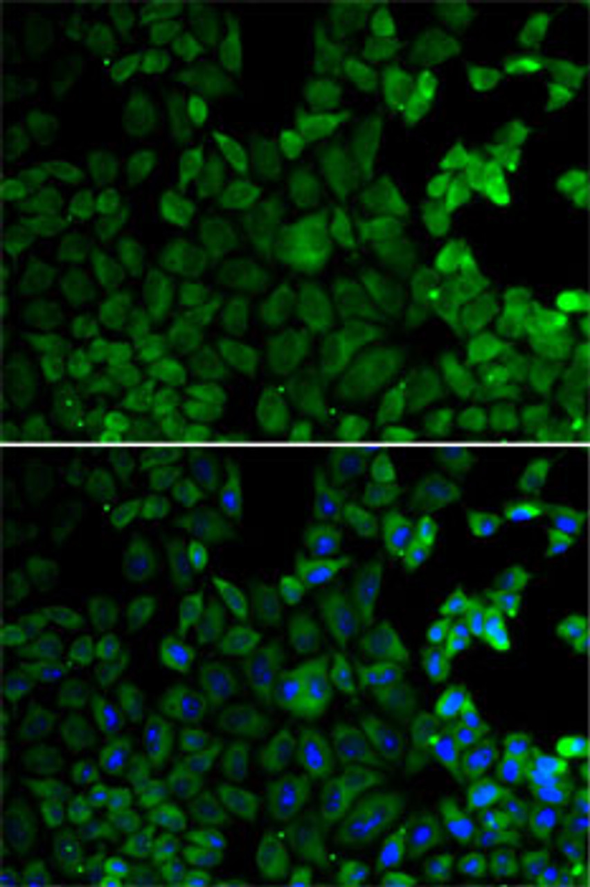 Immunofluorescence analysis of HeLa cells using MSR1 antibody (15-416) . Blue: DAPI for nuclear staining.