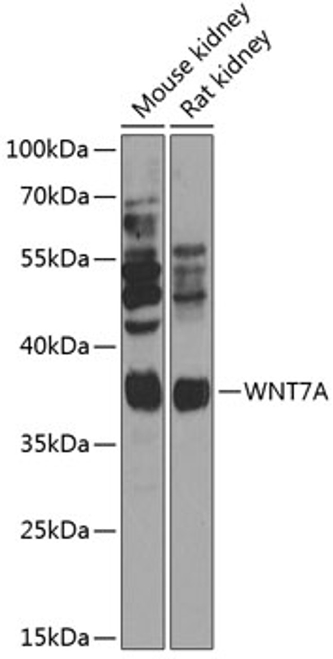 Western blot analysis of extracts of various cell lines, using WNT7A Antibody (15-420) at 1:1000 dilution.<br/>Secondary antibody: HRP Goat Anti-Rabbit IgG (H+L) at 1:10000 dilution.<br/>Lysates/proteins: 25ug per lane.<br/>Blocking buffer: 3% nonfat dry milk in TBST.<br/>Detection: ECL Basic Kit.<br/>Exposure time: 15s.