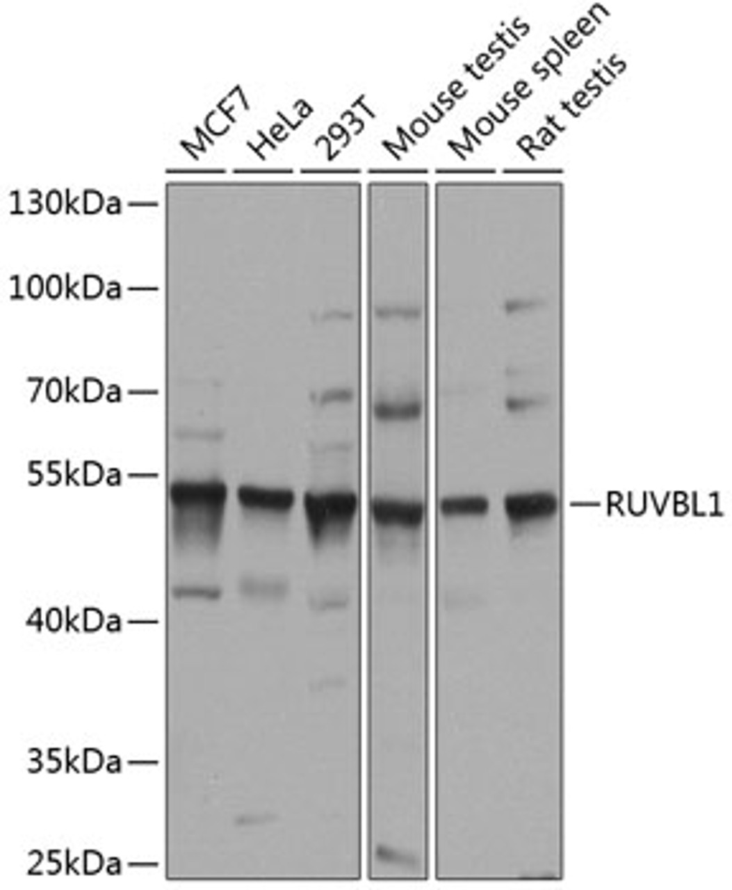 Western blot analysis of extracts of various cell lines, using RUVBL1 antibody (15-421) at 1:1000 dilution.<br/>Secondary antibody: HRP Goat Anti-Rabbit IgG (H+L) at 1:10000 dilution.<br/>Lysates/proteins: 25ug per lane.<br/>Blocking buffer: 3% nonfat dry milk in TBST.<br/>Detection: ECL Basic Kit.<br/>Exposure time: 10s.