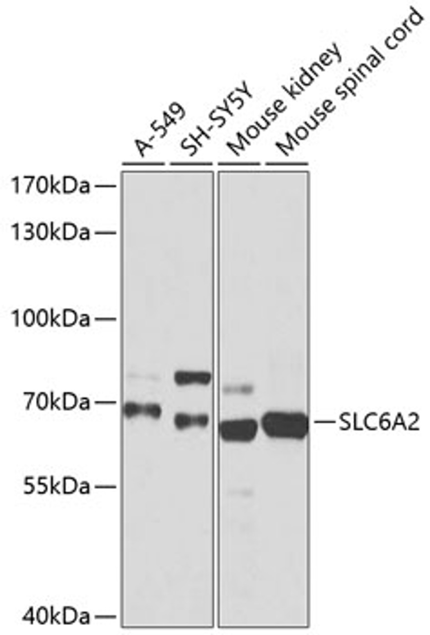 Western blot analysis of extracts of various cell lines, using SLC6A2 antibody (15-429) at 1:1000 dilution.<br/>Secondary antibody: HRP Goat Anti-Rabbit IgG (H+L) at 1:10000 dilution.<br/>Lysates/proteins: 25ug per lane.<br/>Blocking buffer: 3% nonfat dry milk in TBST.<br/>Detection: ECL Basic Kit.<br/>Exposure time: 10s.