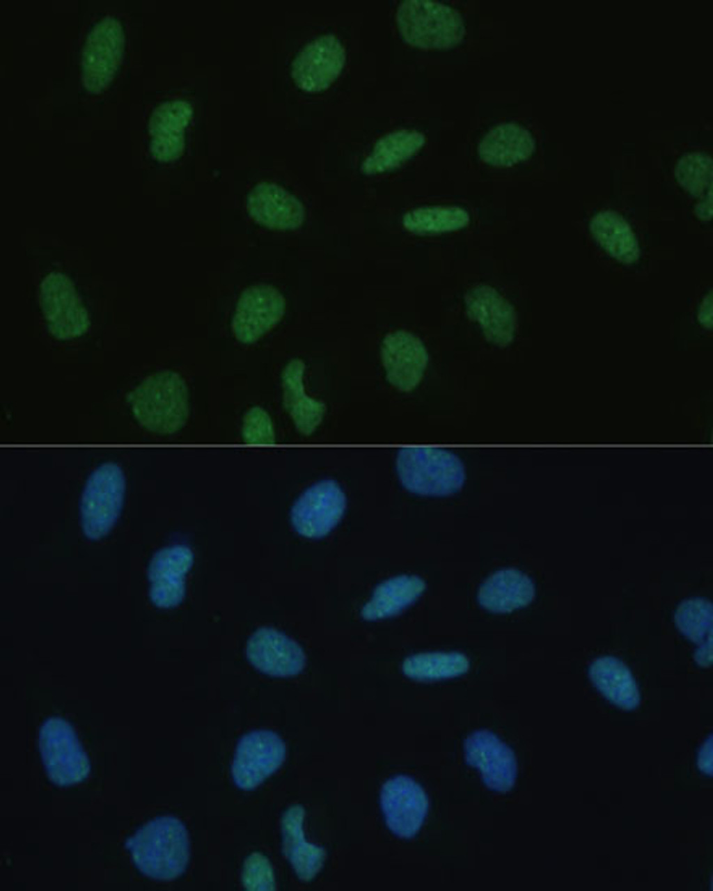 Immunofluorescence analysis of U-2 OS cells using MKL1 Polyclonal Antibody (15-431) at dilution of 1:100 (40x lens) . Blue: DAPI for nuclear staining.