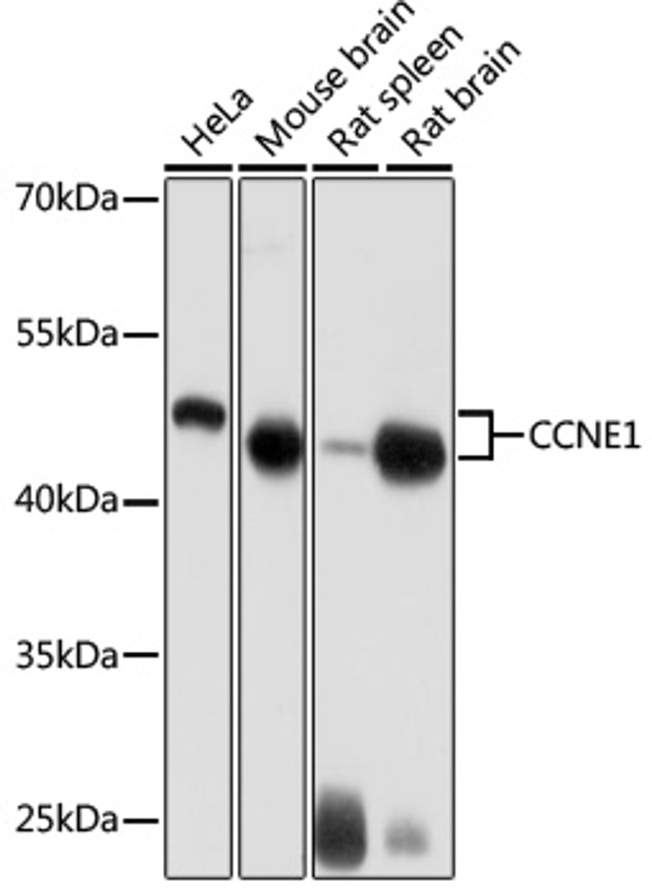 Western blot analysis of extracts of various cell lines, using CCNE1 antibody (15-436) at 1:1000 dilution.<br/>Secondary antibody: HRP Goat Anti-Rabbit IgG (H+L) at 1:10000 dilution.<br/>Lysates/proteins: 25ug per lane.<br/>Blocking buffer: 3% nonfat dry milk in TBST.<br/>Detection: ECL Basic Kit.<br/>Exposure time: 10s.