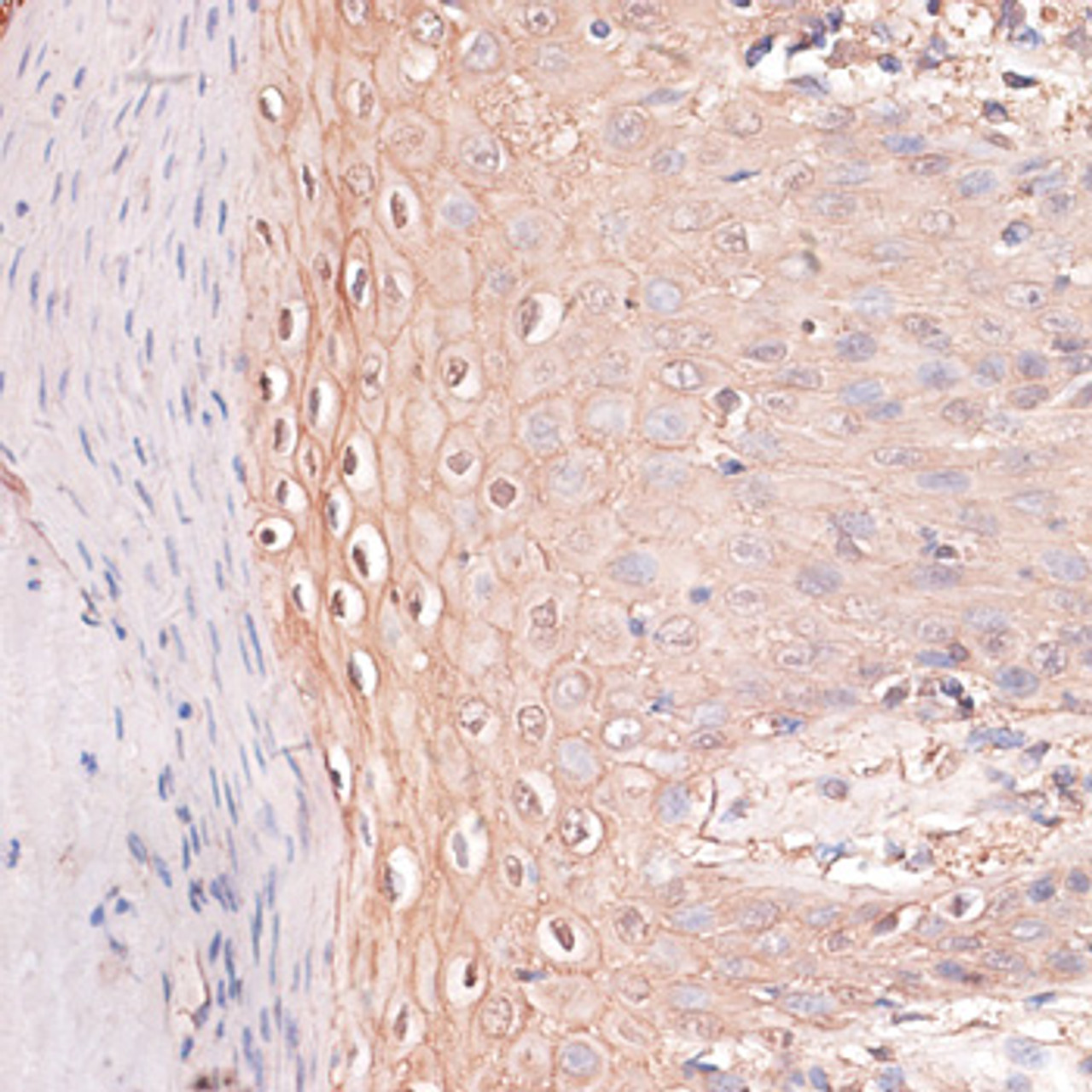 Immunohistochemistry of paraffin-embedded human skin using CDH3 antibody (15-441) at dilution of 1:100 (40x lens) .