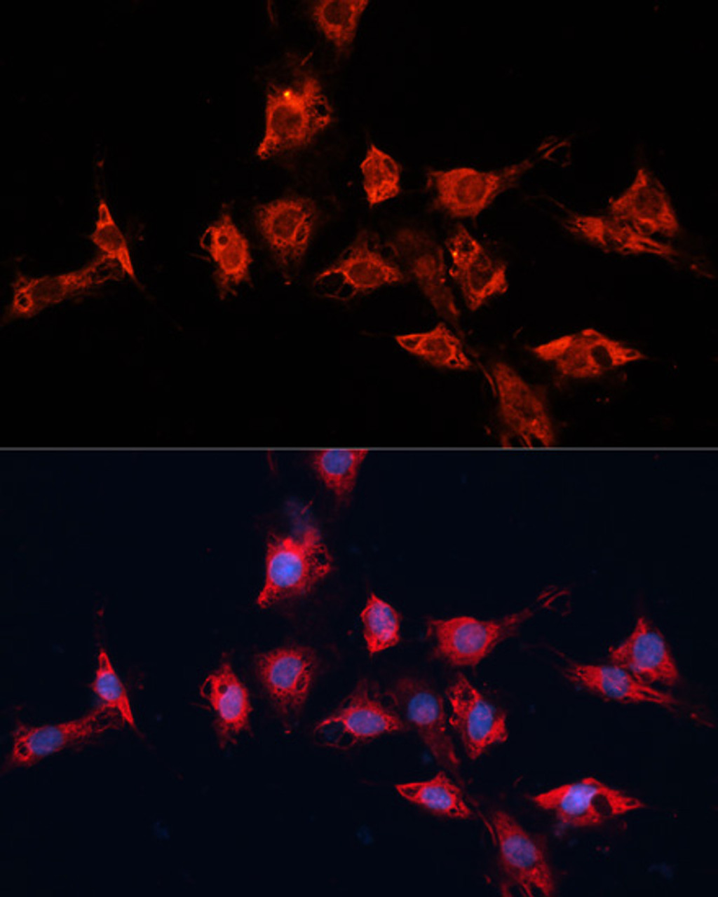 Immunofluorescence analysis of C6 cells using ADAM11 antibody (15-449) at dilution of 1:100. Blue: DAPI for nuclear staining.